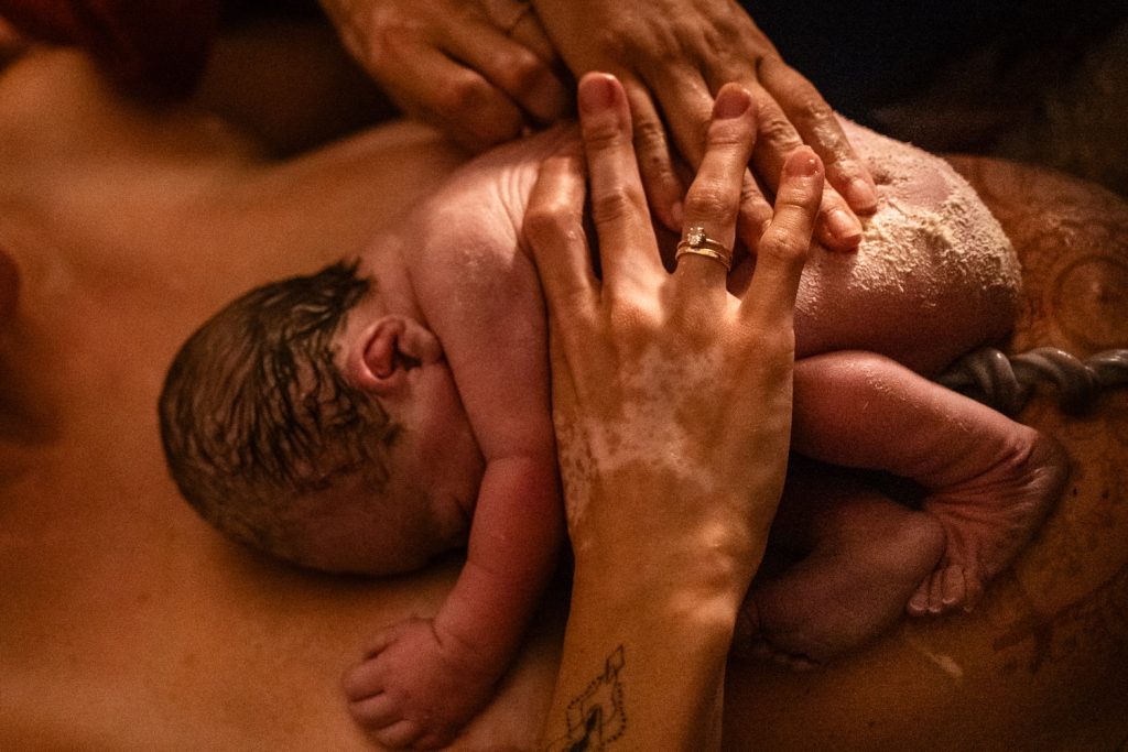 Frisch geboren liegt das Baby voller Käseschmiere am Bauch der Mutter